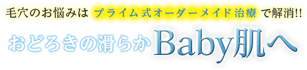 毛穴のお悩みはプライム式オーダーメイド治療で解消‼︎おどろきの滑らかBaby肌へ